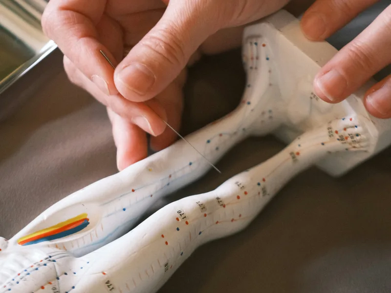 Acupuncture at Thornapple River Chiropractic in Grand Rapids
