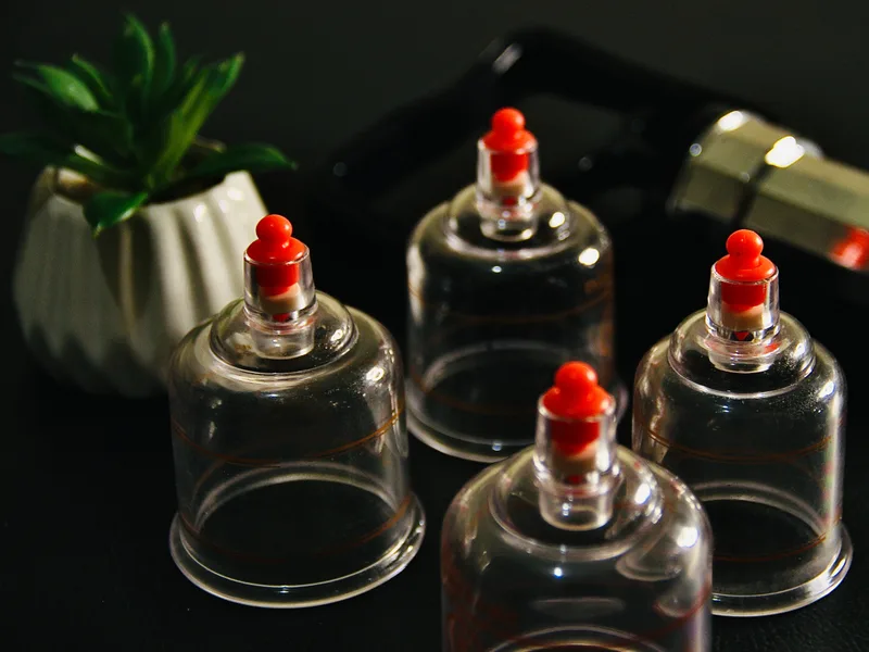 How Cupping Therapy works at Thornapple River Chiropractic