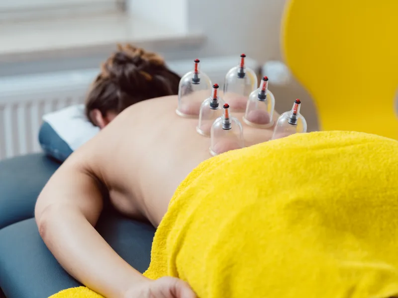 Cupping Therapy at Thornapple River Chiropractic in Grand Rapids