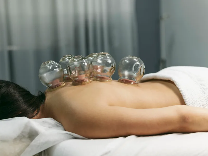 Cupping Therapy at Thornapple River Chiropractic in Grand Rapids