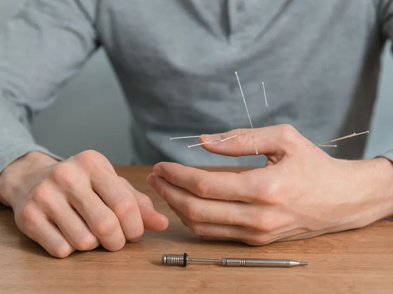 Dry Needling at Thornapple River Chiropractic in Grand Rapids