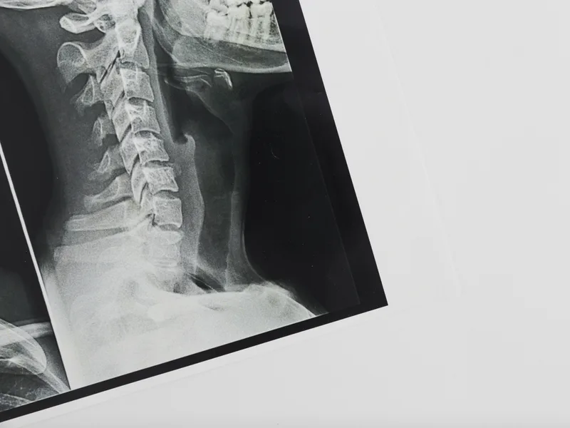 X-Rays at Thornapple River Chiropractic in Grand Rapids